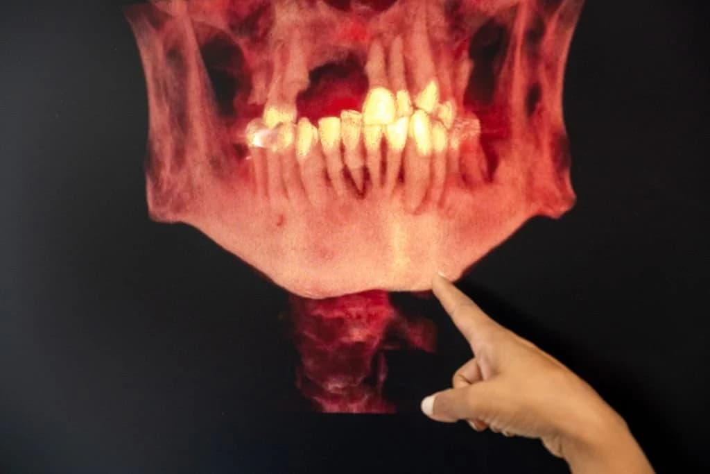 A clinician tracing the lower jaw on a 3D cone beam scan