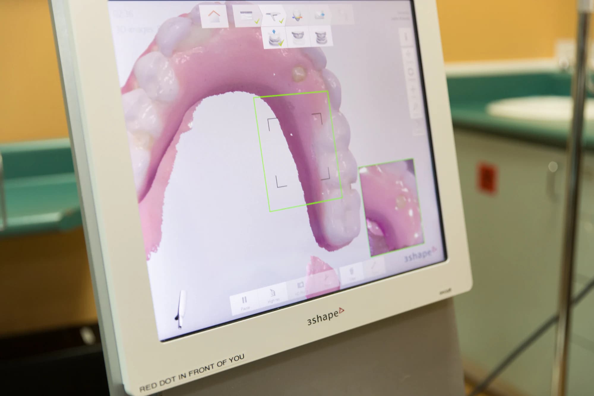 3D CBCT scan used to plan multiple dental implant placement