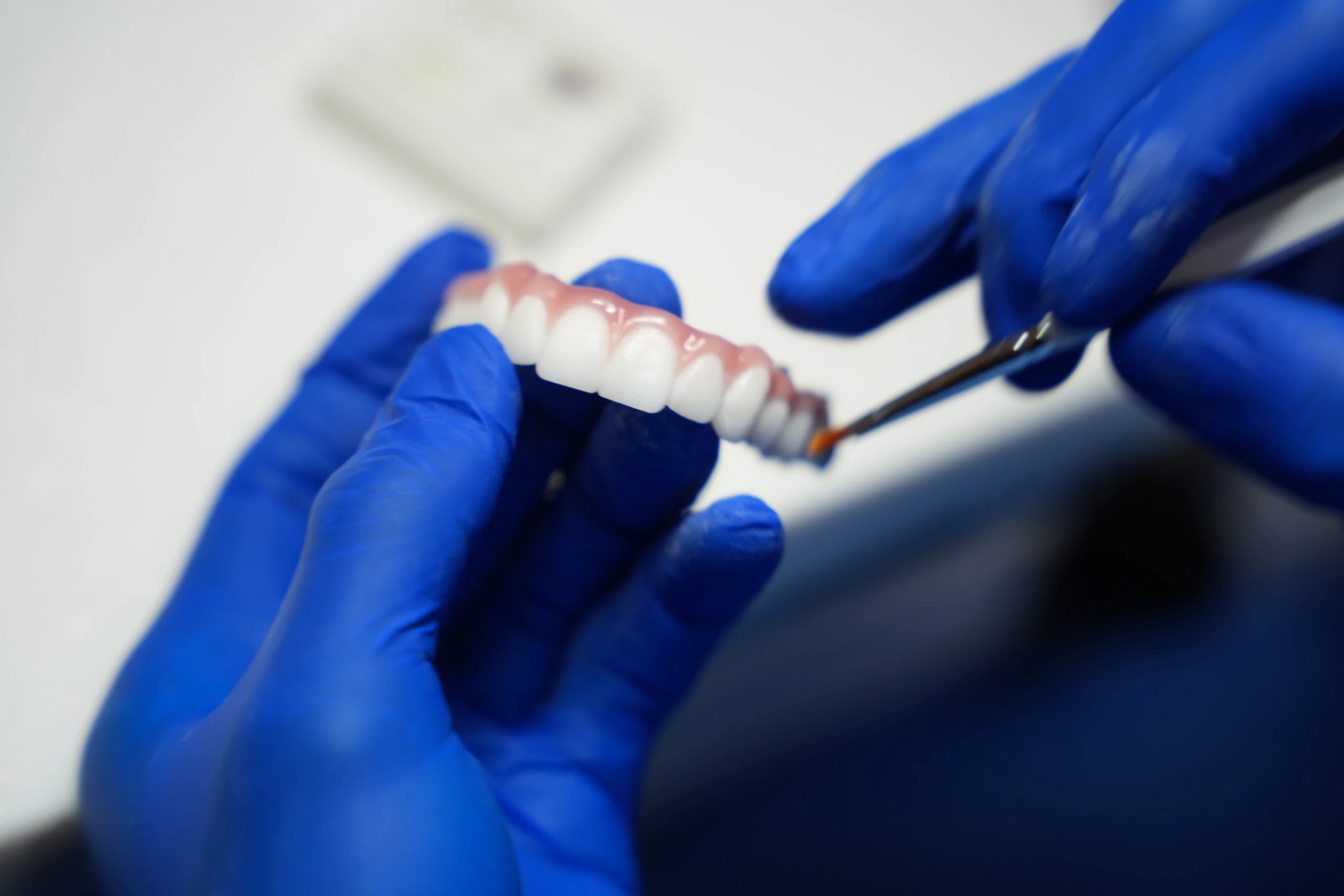 Traditional multi-unit dental bridge being adjusted