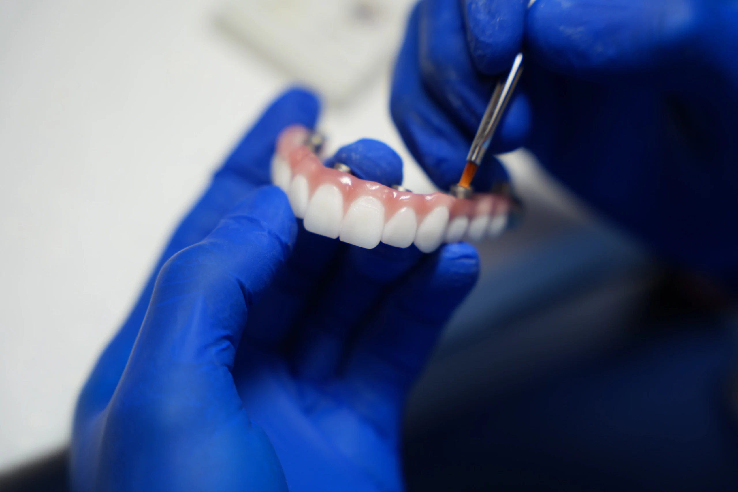 Permanent zirconia teeth being refined in the on-site lab