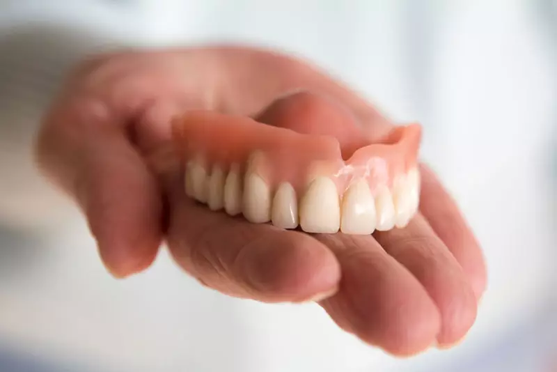 Traditional removable dentures
