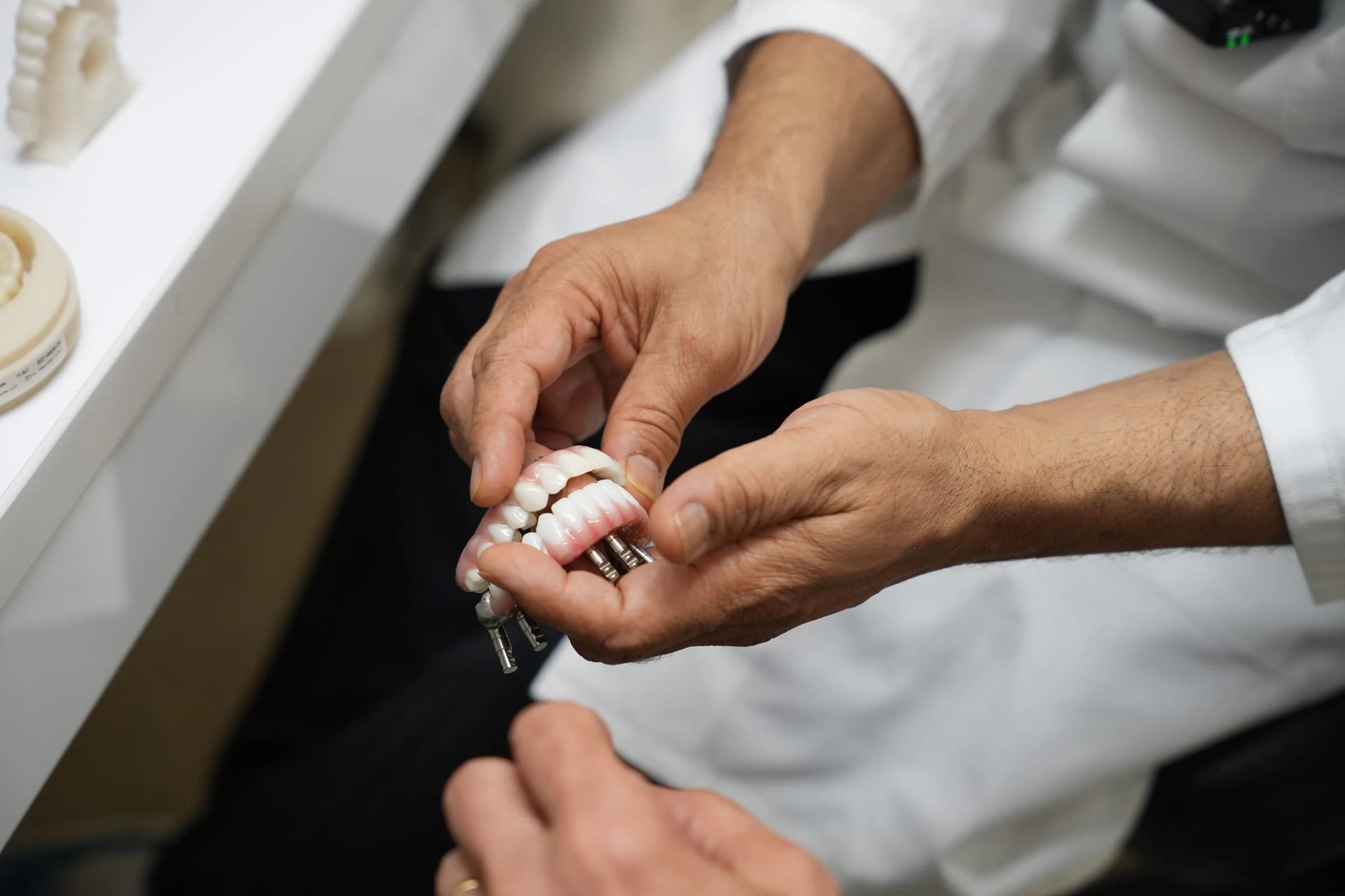A full-arch implant bridge held in hand, its abutments visible