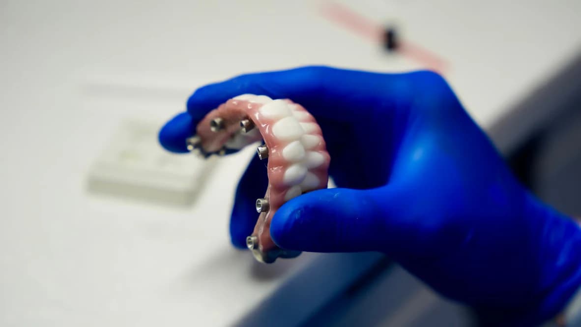 A finished full-arch prosthesis held up in the lab