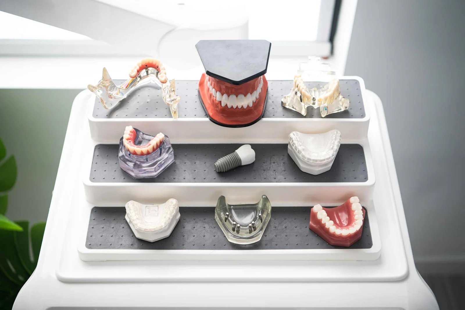 Shelves of dental models showing dentures, implant-supported arches and a single implant crown