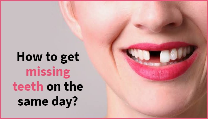 Missing Teeth On The Same Day