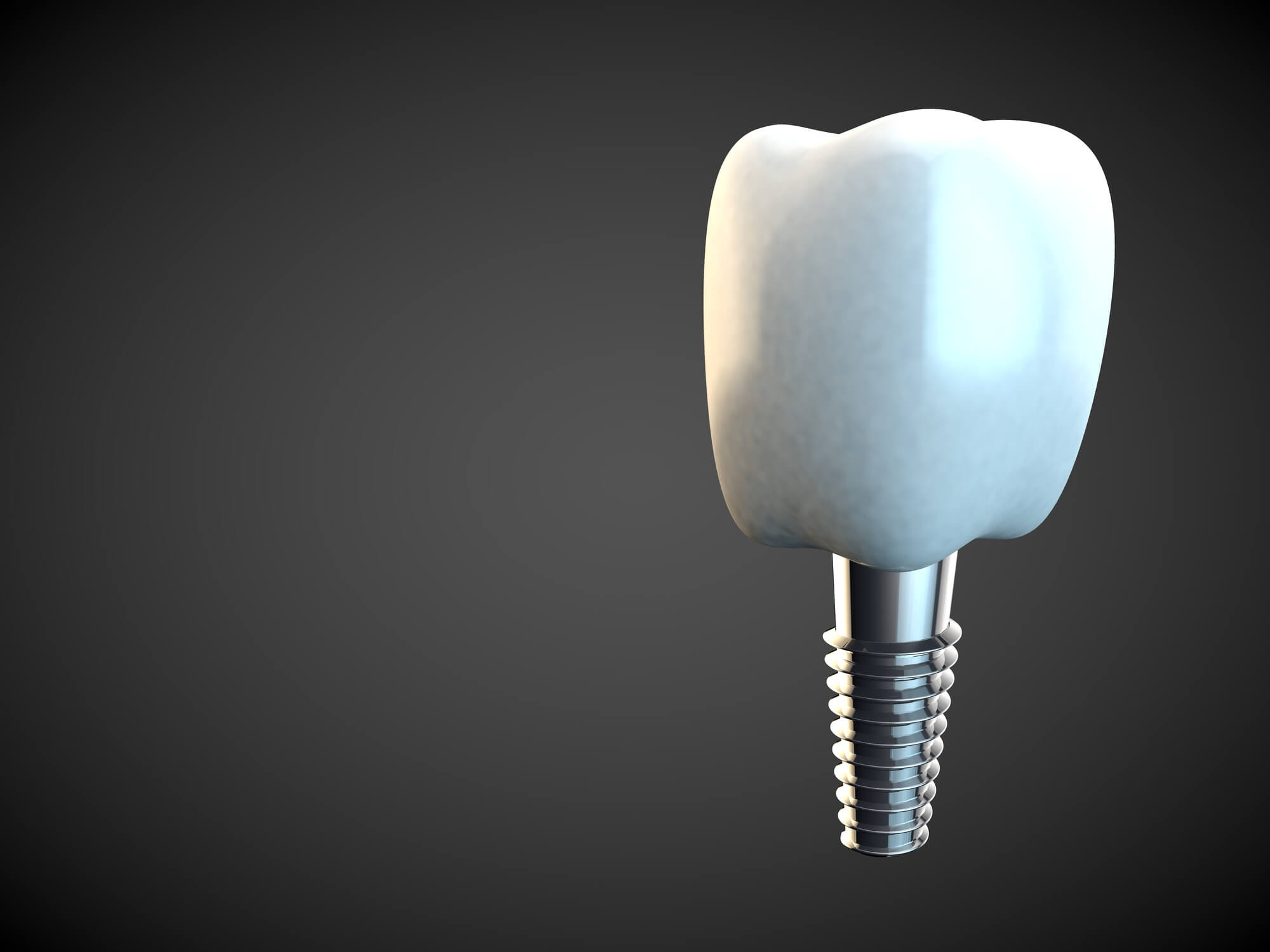 single dental implant from the center for dental implants