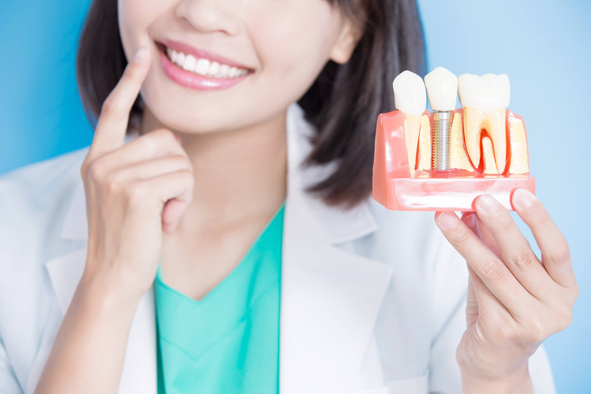 smiling dentist holding a model of dental implants 